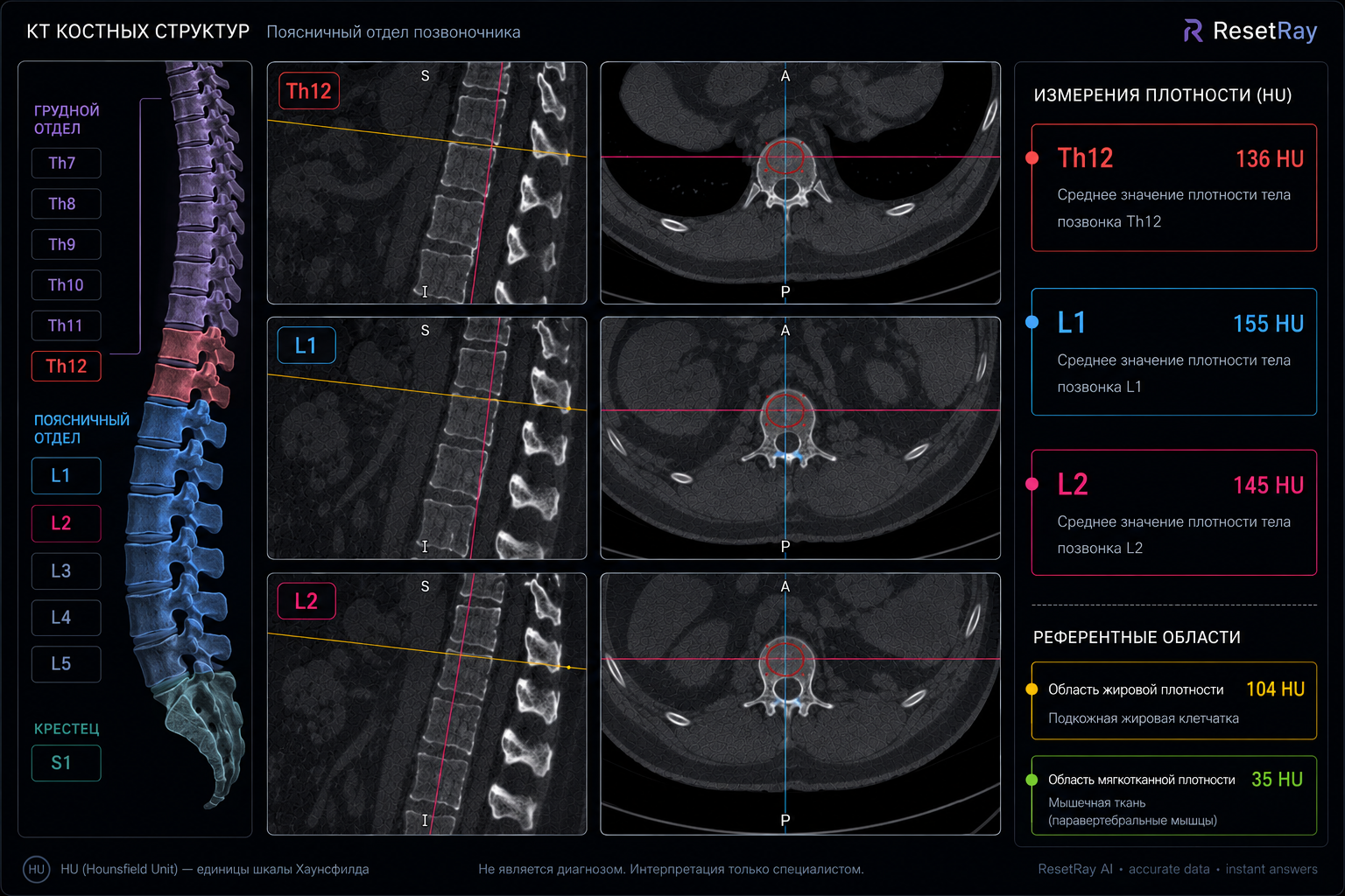 ResetRay technical CT preview